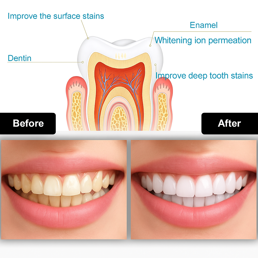 SMILEKIT™ Whitening Set